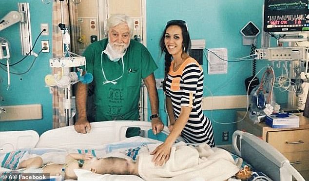 美国连体双胞胎成功分离案例,美国连体分离手术真实案例