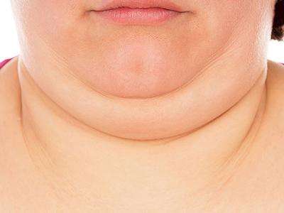 25岁了脖子还能长长吗,25岁脖子上长了两条深纹