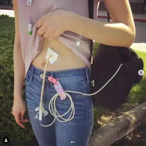 全身瘫痪，经历10次手术后康复，她就这样一步一步实现了医生梦