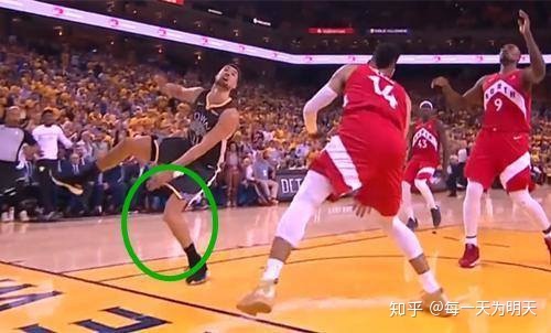 膝关节前交叉韧带轻微损伤的原因,膝前交叉韧带损伤MR表现