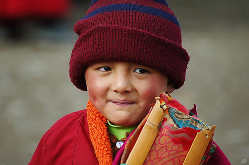 脸部红血丝严重咋办,脸部皮肤带血丝怎么去掉