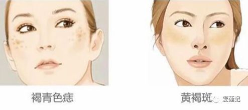 用祛斑霜为啥斑还越来越多,不要浪费护肤品