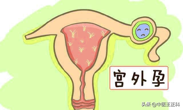 深圳私企女职工怀孕,广东深圳女子怀孕