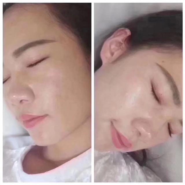 七老修复激素脸是真的假的,七老真的能修复激素脸吗