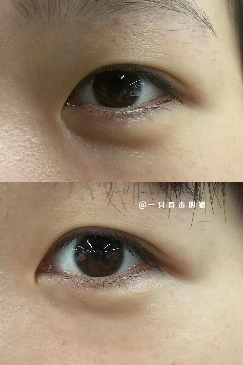 平价抗皱去黑眼圈的眼霜测评,眼霜三十天测评