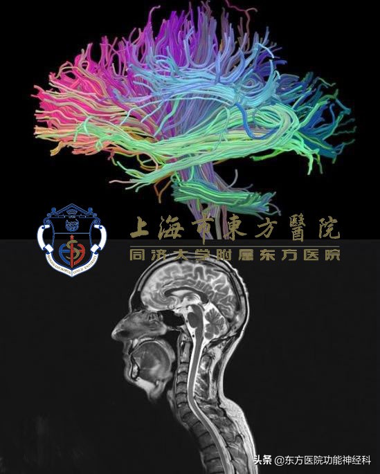 如何有效治疗精神分裂症,狂躁精神分裂症怎么治疗