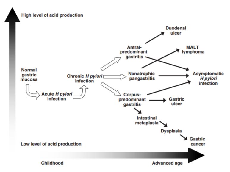 幽门螺旋杆菌胃病吃什么可根除,幽门螺旋杆菌阳性中医怎么调养