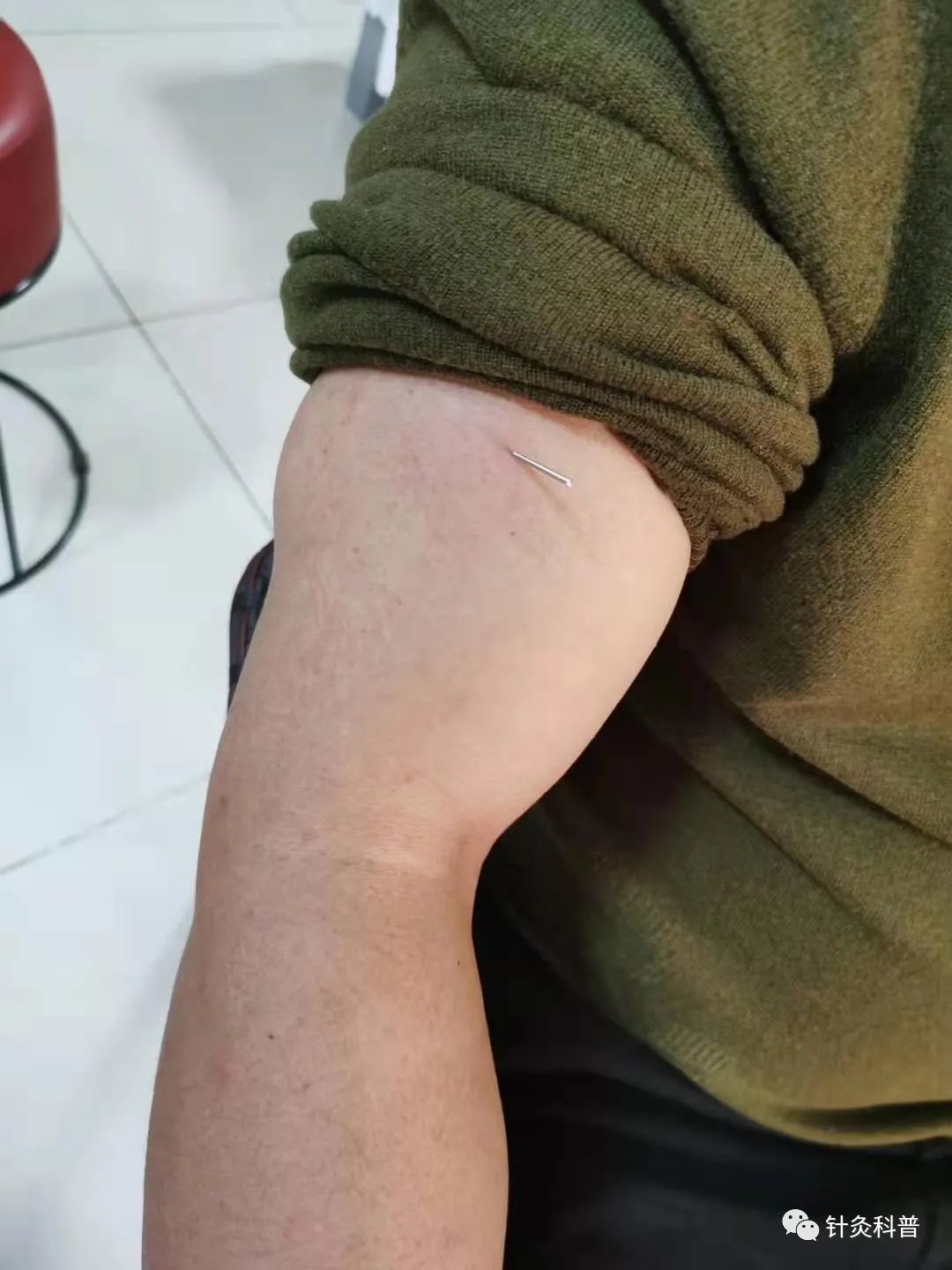 肩背痛一针针灸法,针灸治疗颈肩腰腿痛