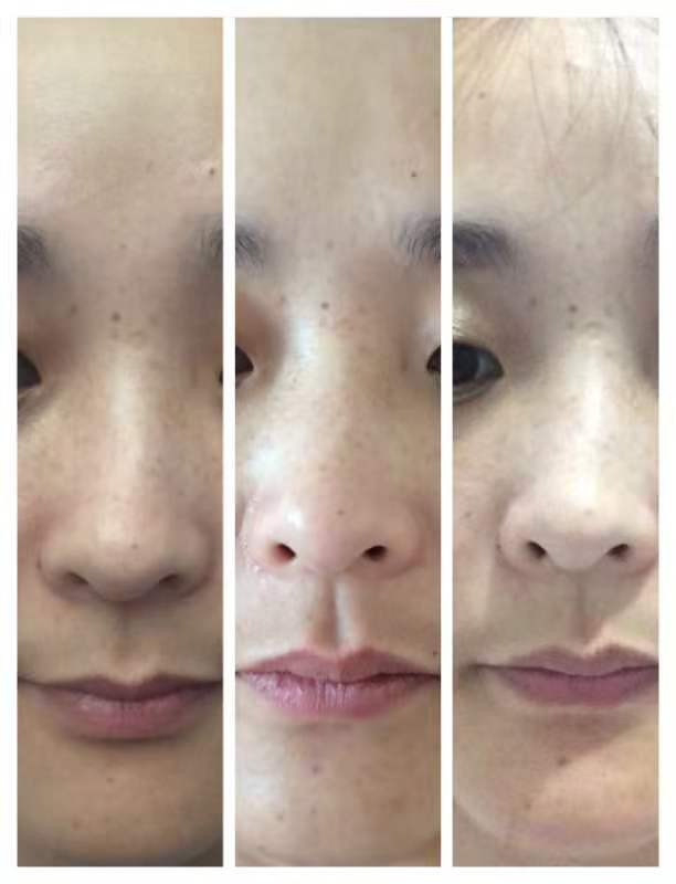 好物分享拒绝秒赞,好物分享护肤拒绝黄脸婆