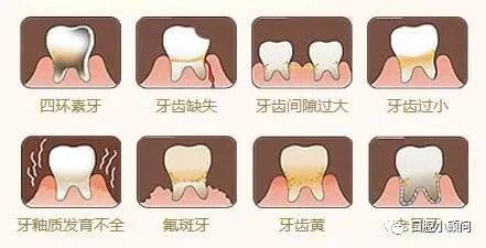 鎬庝箞缇庣櫧鐗欓娇,鐗欓娇璐寸墖缇庣櫧