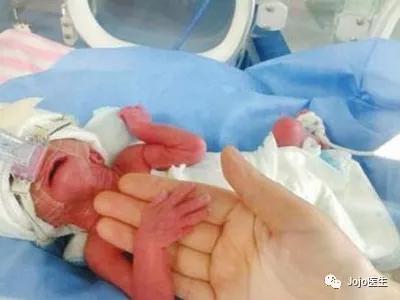 网红殴打孕妇的危害,网红暴打孕妇致先兆流产后再道歉