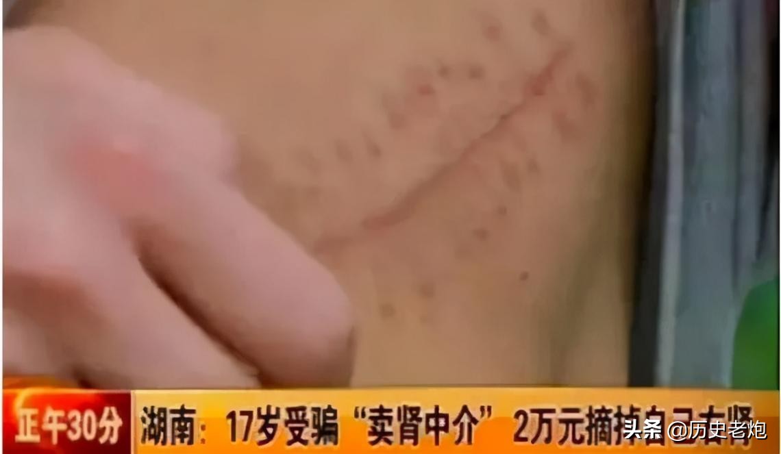 10年前卖肾少年卖苹果手机,10年前卖肾卖手机的人