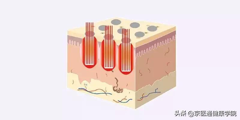 胶原蛋白真的有必要买吗,新手一定要知道的胶原蛋白骗局