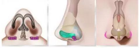 化妆真的能完全遮住瑕疵吗,化妆也掩盖不了岁月的痕迹