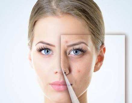 华亦俏朱红博士说:祛痣应该注意什么?