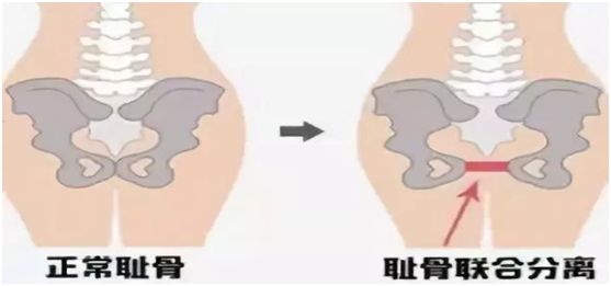 是什么让一个女人哭红了眼,43岁的女人自动流泪咋回事