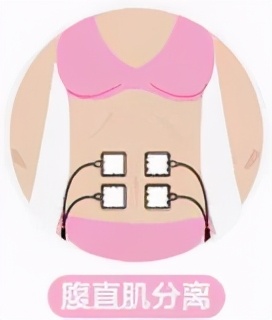 三指半到闭合,一个双胞胎妈妈的腹直肌康复之路