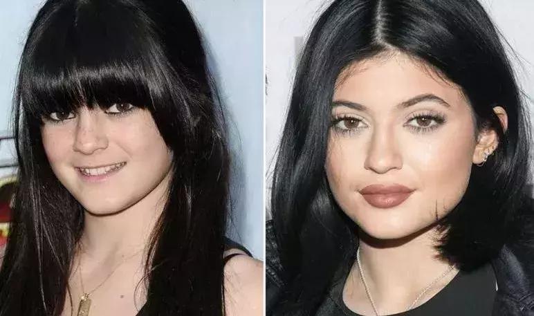 厚嘴唇有多美,厚嘴唇也很好看的女生