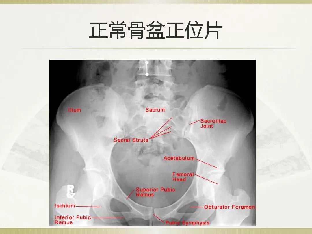 骨科x光片读片技巧,放射科骨科读片教程