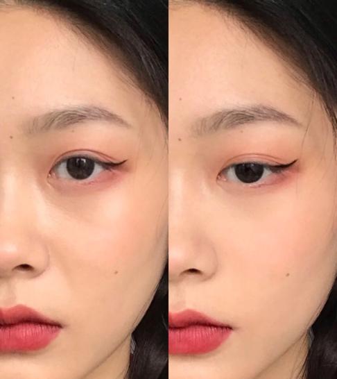 脸部什么纹路最显老,脸上显老的两条线