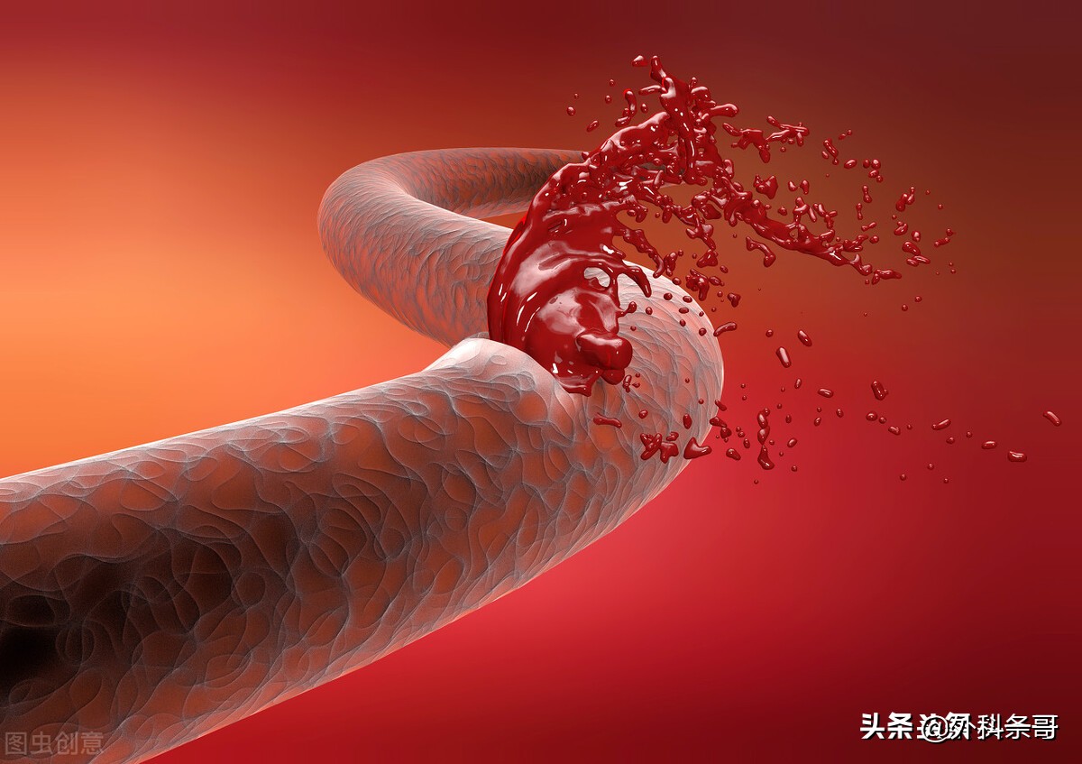 脑出血脑疝开颅手术后遗症,脑出血后遗症偏瘫能手术治疗吗