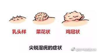 为什么说检测低危型HPV没有意义？低危型HPV阳性是否＝尖锐湿疣？