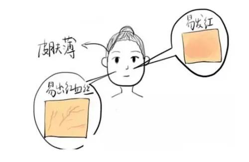 让人羞红脸是什么原因,红脸蛋到底是什么皮肤