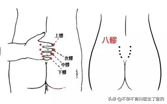 艾灸助孕穴位全图,艾灸助孕要注意什么