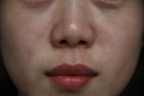 女性唇毛可以刮吗,女性唇毛比较多怎么调理