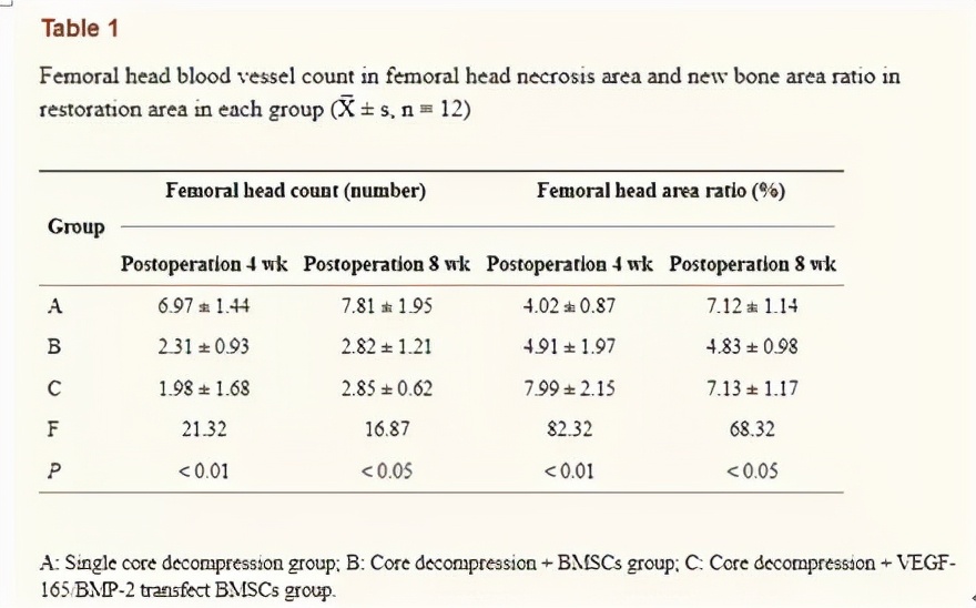 股骨头坏死干细胞移植手术能好吗,干细胞可以治疗股骨头坏死吗