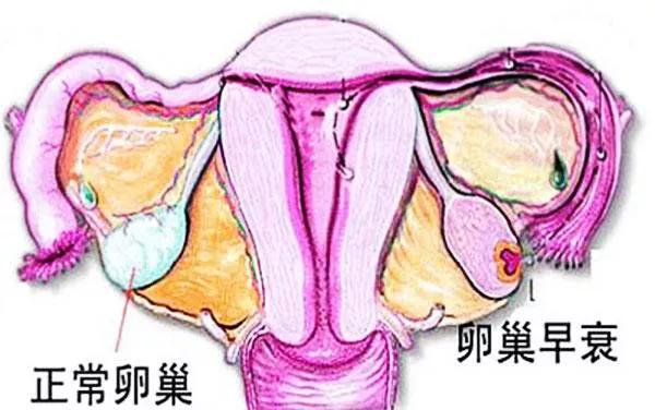 卵巢早衰和脸上斑有关系吗,卵巢早衰脸上皱纹会多吗
