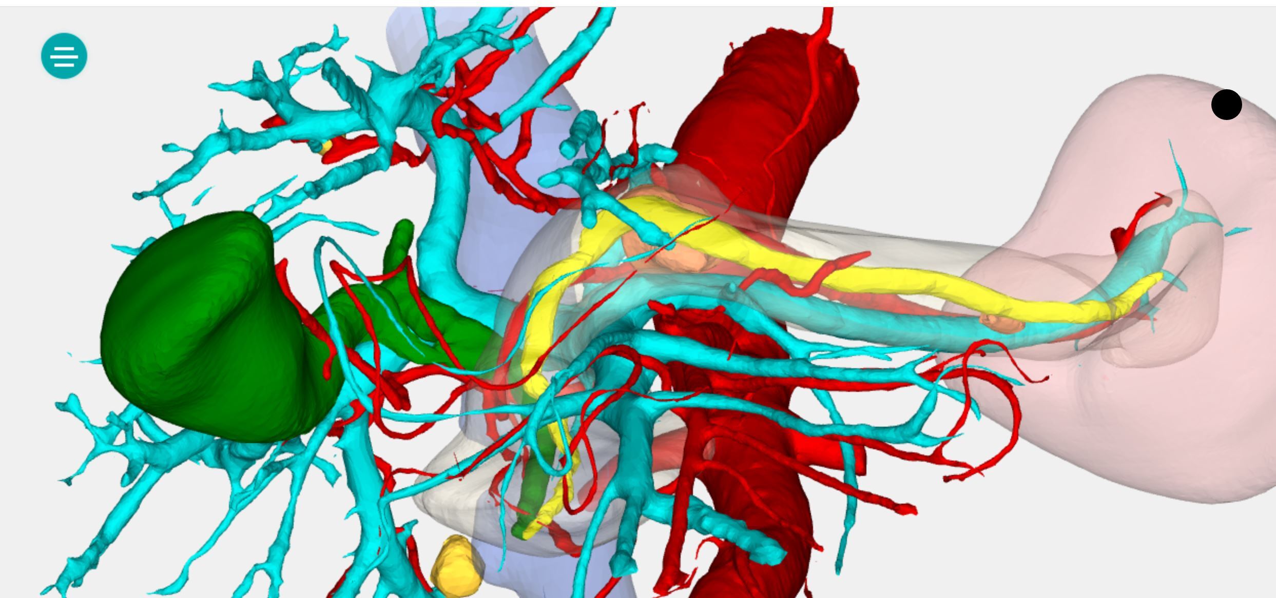 胰腺囊肿3.2x4.2必须手术吗,三厘米的胰腺头良性囊肿如何手术