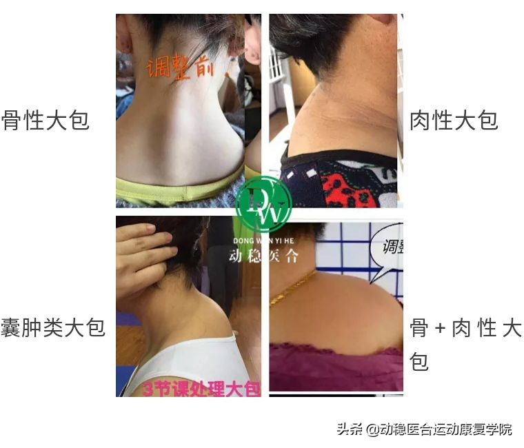 后背式呼吸法的好处,后背式呼吸好处