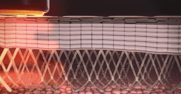 脸发腮的解决方法图解,如何改善发腮或避免发腮