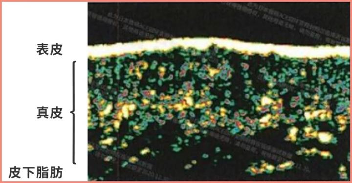300块的网红美容仪有效果吗,网红家用美容仪测评
