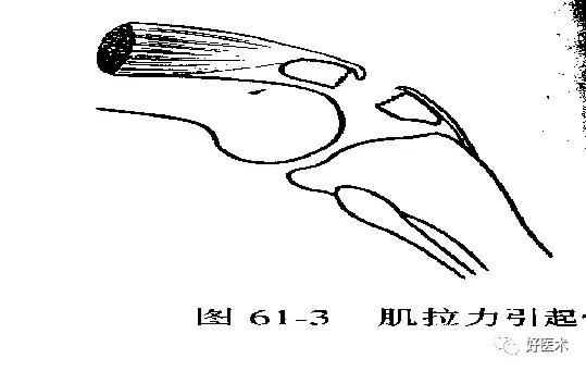 骨科急救处理流程图,骨科急救原则及注意事项