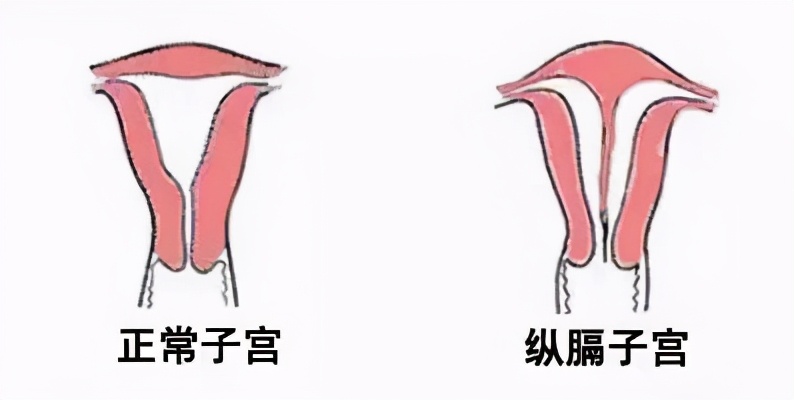 受孕卵没有成功着床是什么原因,明明怀孕为什么宫内没有孕囊
