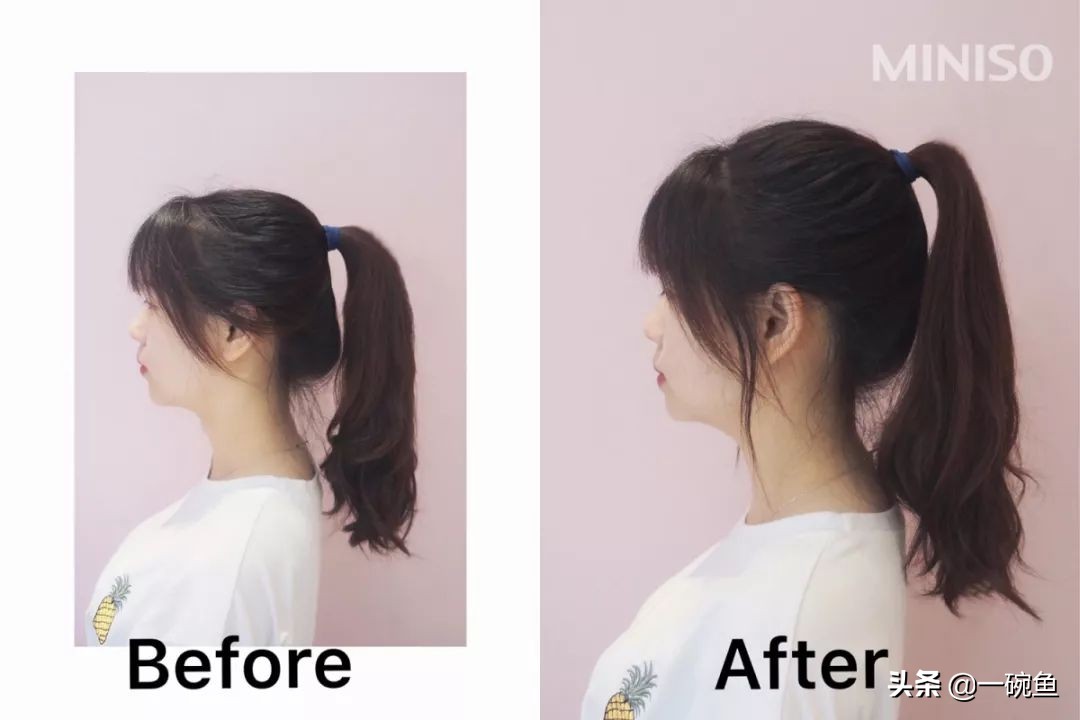 天生头扁怎么矫正,天生头扁在医学上怎么弄