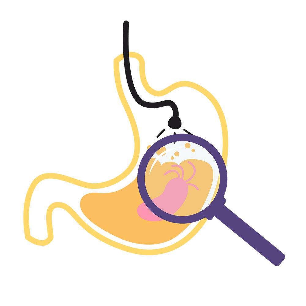 早期胃癌可通过体检查出来吗,要体检什么才能检查出胃癌