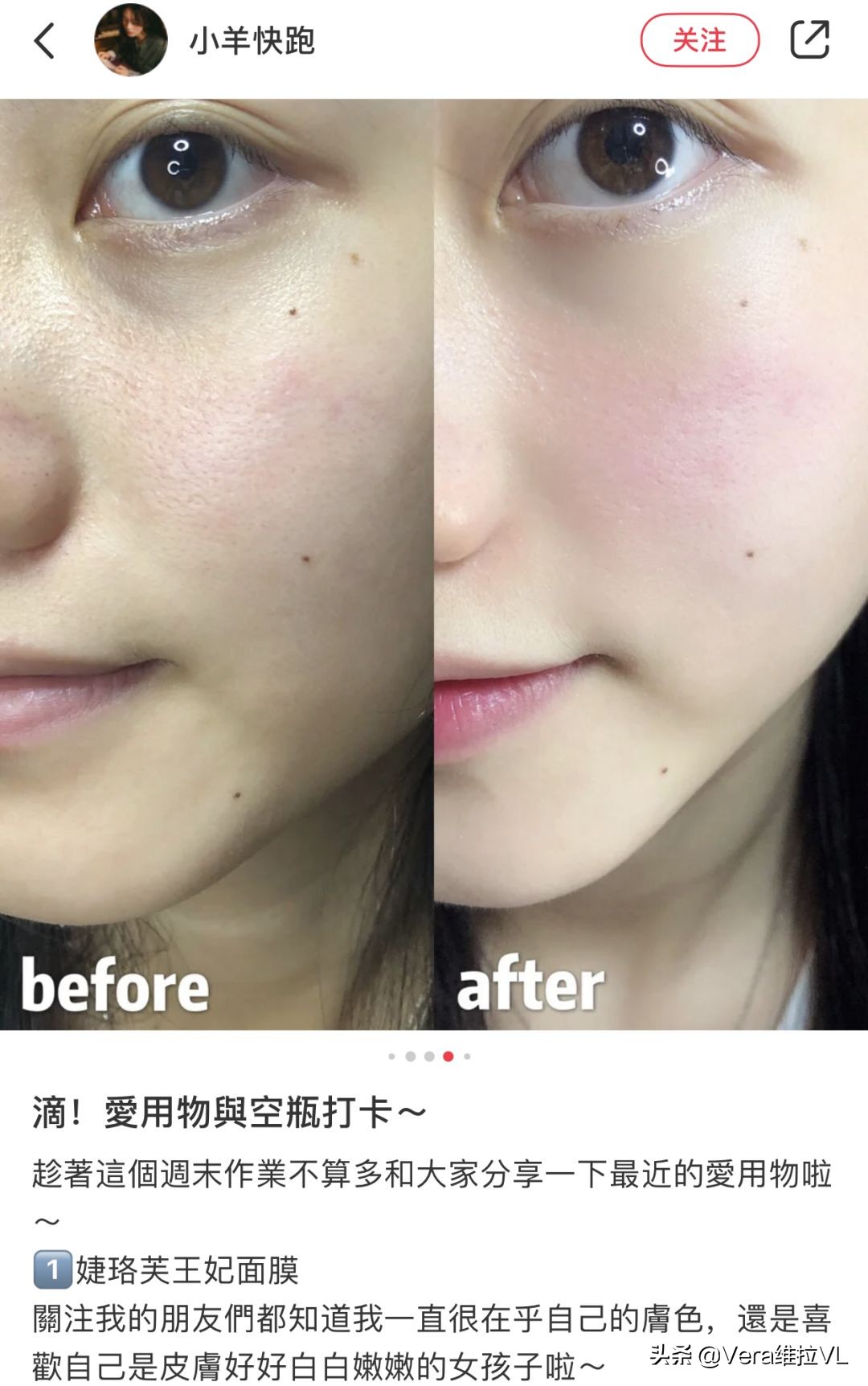 法国进口鱼子精华舒爽美肌面膜,法国珍贵鱼子精华奢润抗皱面膜