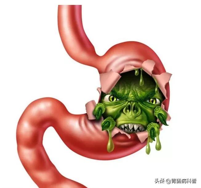 萎缩性胃炎怎么治疗最好得快,萎缩性胃炎能不能彻底治好