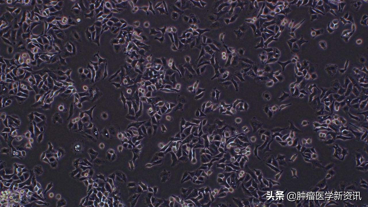 alk阳性肺癌能用免疫治疗吗,alk阳性肺癌手术后复发率