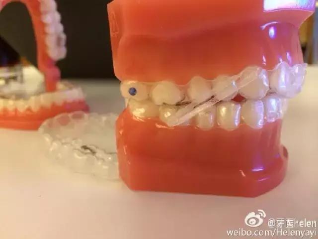 鐗欑闅愬舰鐭绉戞櫘,Helen榻跨涓績