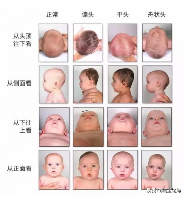 宝宝头型睡扁会不聪明吗,宝宝头型睡得好丑