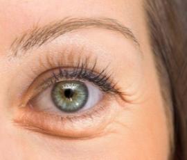 怎么判断你是什么类型的黑眼圈,判断你是什么类型的黑眼圈