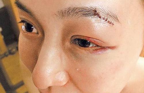 范玮琪摔倒陈建州,范玮琪摔伤的原因