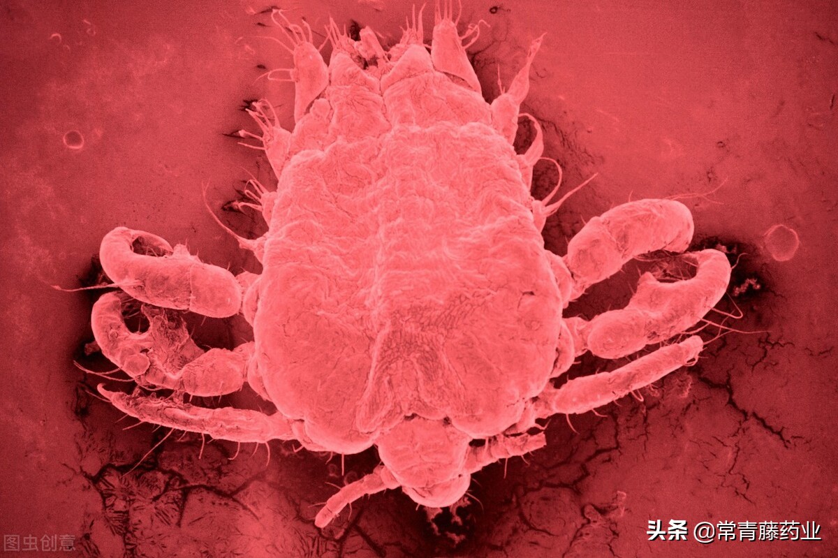 如何判断阴虱病彻底治愈,你知道阴虱哪里来的