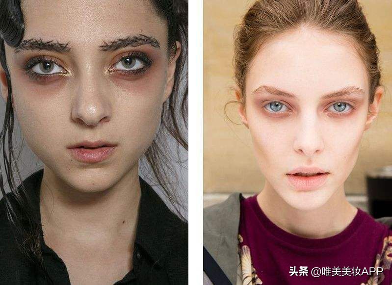 最常见的2种黑眼圈你中招了吗,黑眼圈分三种你都知道吗