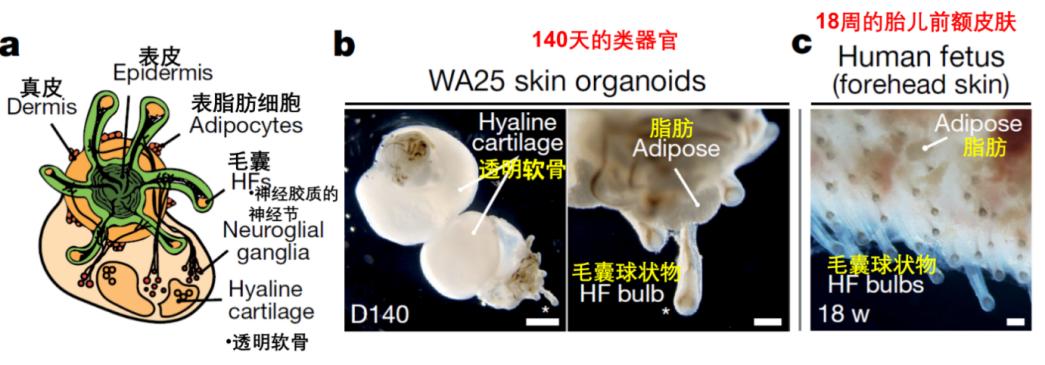 脱发人群超25亿解救头发从它开始,脱发最新研究成果
