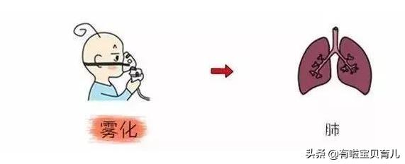 雾化比抗生素的危害更大,雾化比输液更可怕在家雾化安全吗